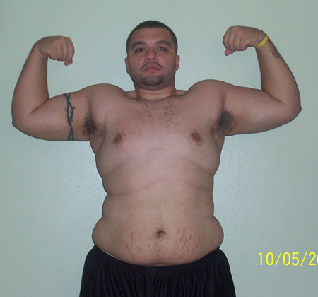 Weight Loss Photo 3